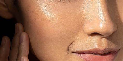 Skin treatments in Fourways