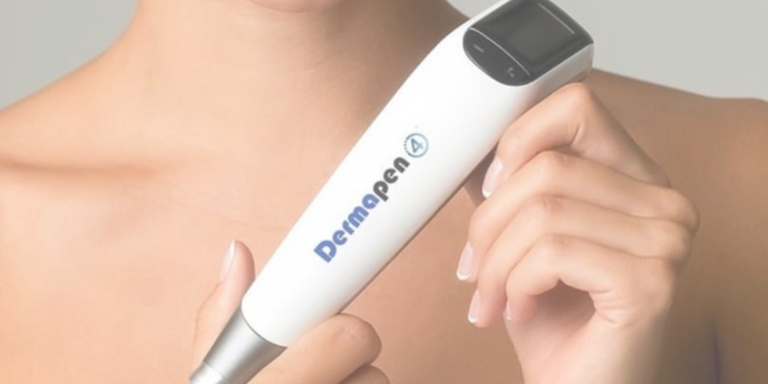 Microneedling in Fourways