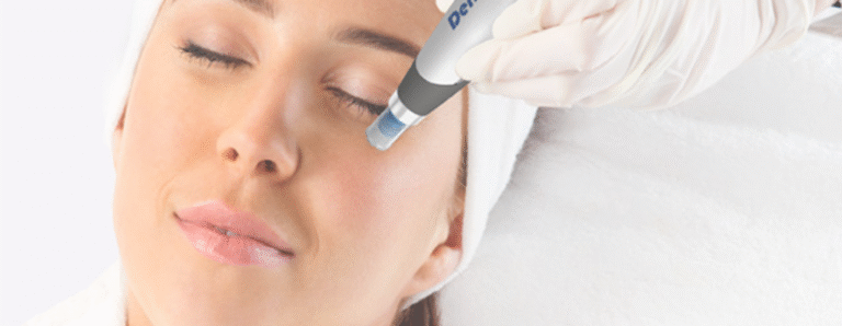 Precision Microneedling