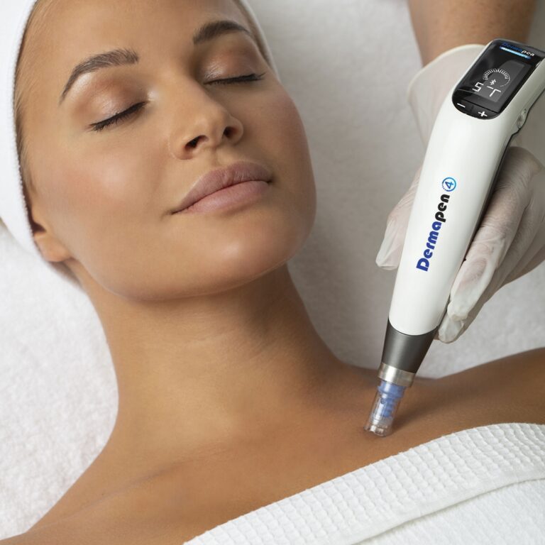 Microneedling Fourways