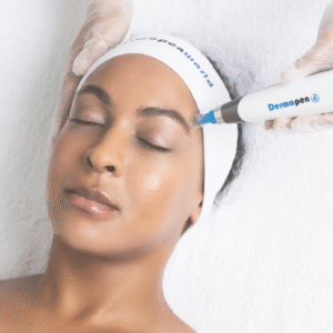 Dermapen microneedling