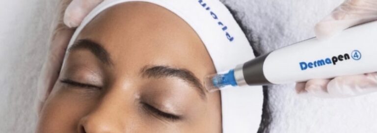 dermapen precision microneedling+uber peel