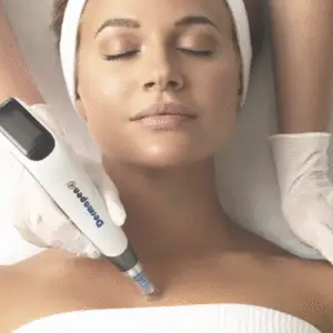 Dermapen Microneedling